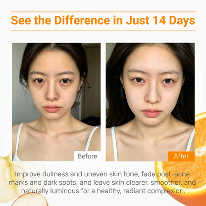 Vitamin C Brightening Facial Serum